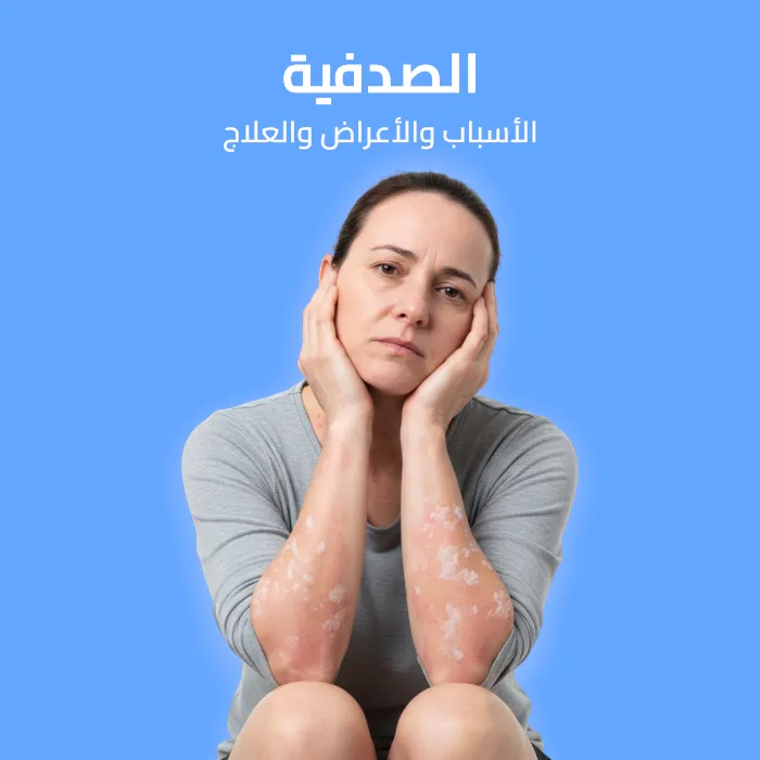 psoriasis: causes, symptoms and treatment 