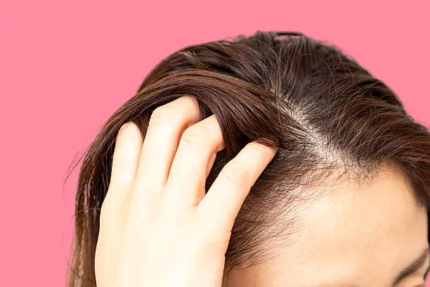 Benefits of cloves for the scalp