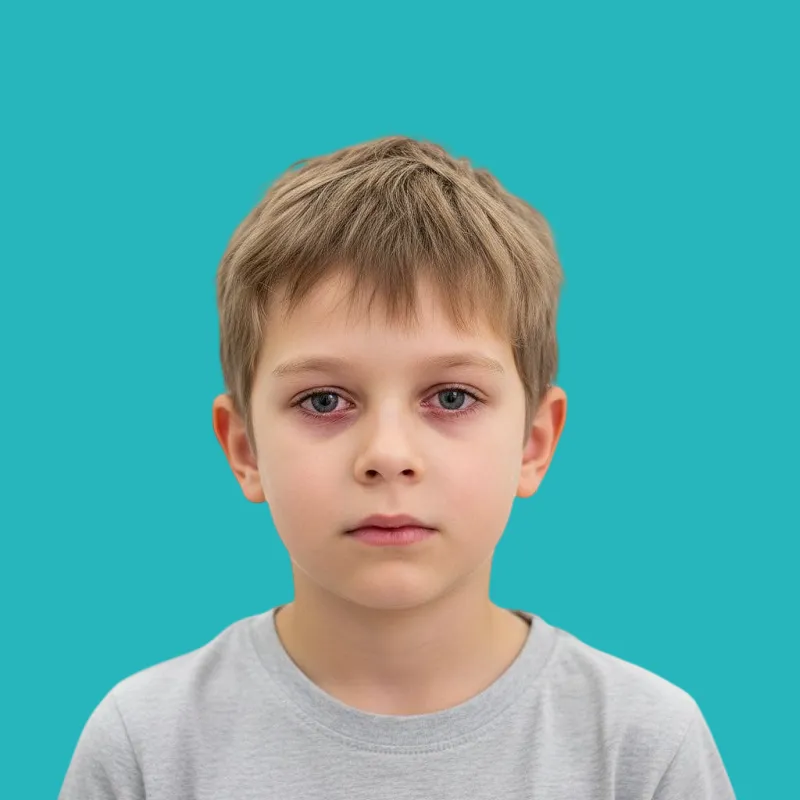 What are the treatment methods for dry eyes in children?