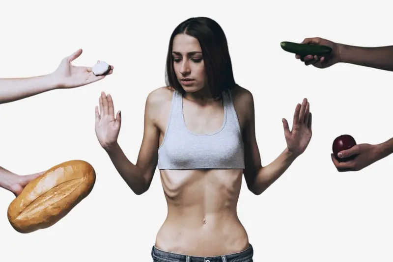 فقدان الشهية العصبية