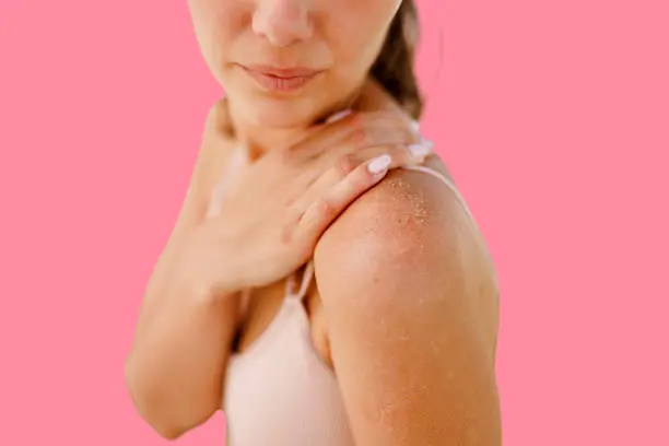 Dry skin during pregnancy