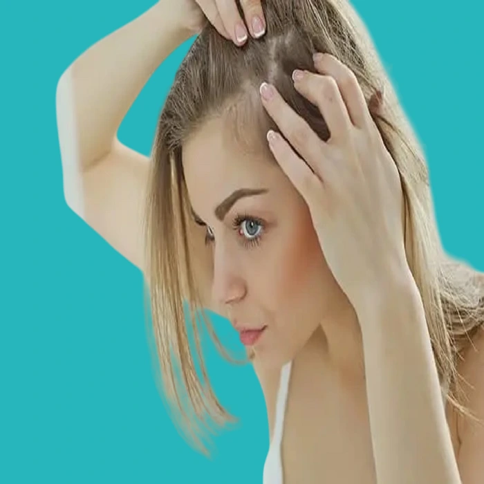 what is the difference between scalp psoriasis and dandruff? 
