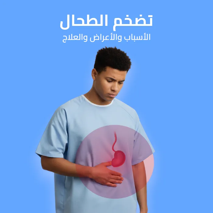 تضخم الطحال: الأسباب والأعراض والعلاج 