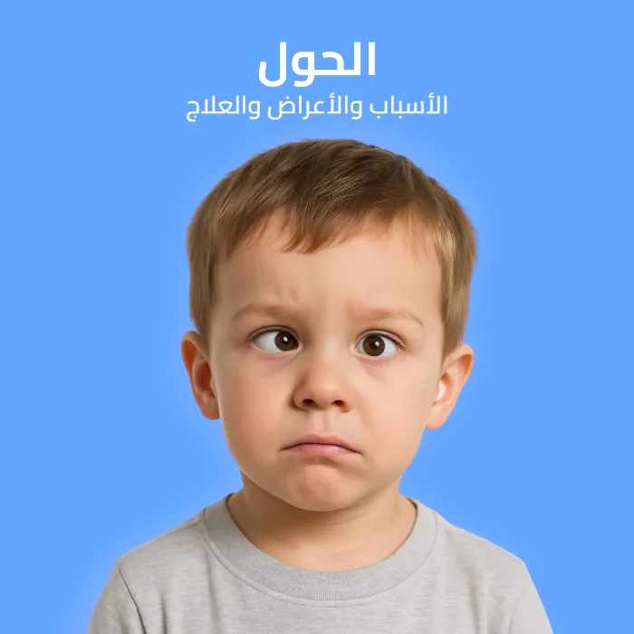 الحول: الأسباب والأعراض والعلاج 