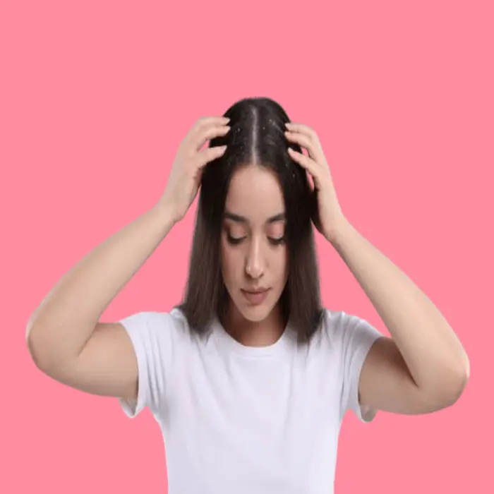 Natural recipes to get rid of dandruff permanently 