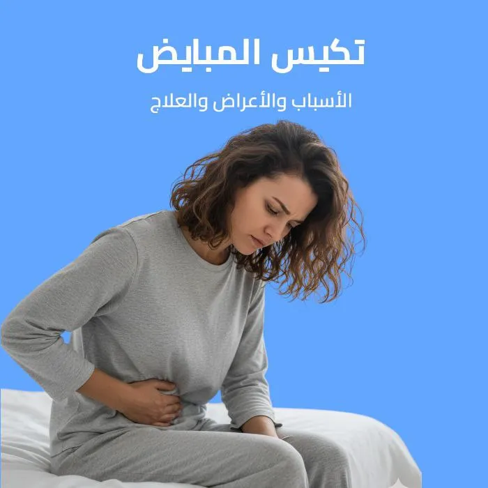 تكيس المبايض: الأسباب والأعراض والعلاج 
