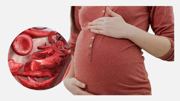 Impact of the disease on pregnancy