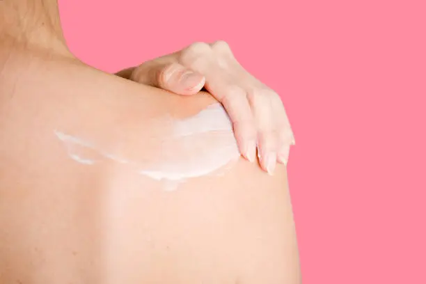 Moisturizing the skin to treat back acne