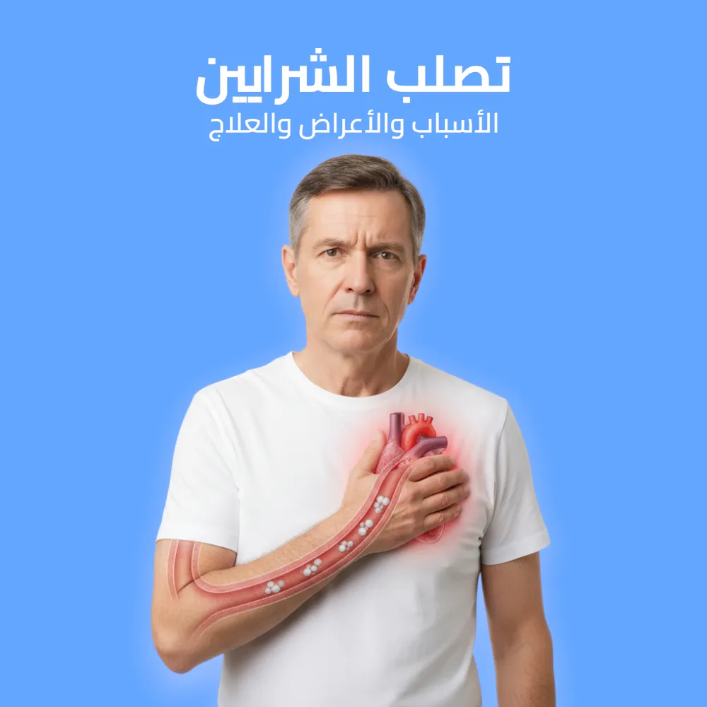 تصلب الشرايين: الأسباب والأعراض والعلاج 