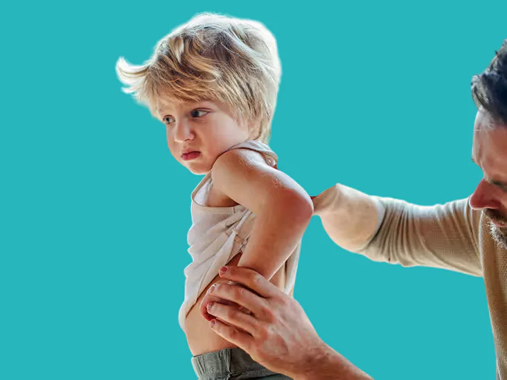 rheumatic fever
