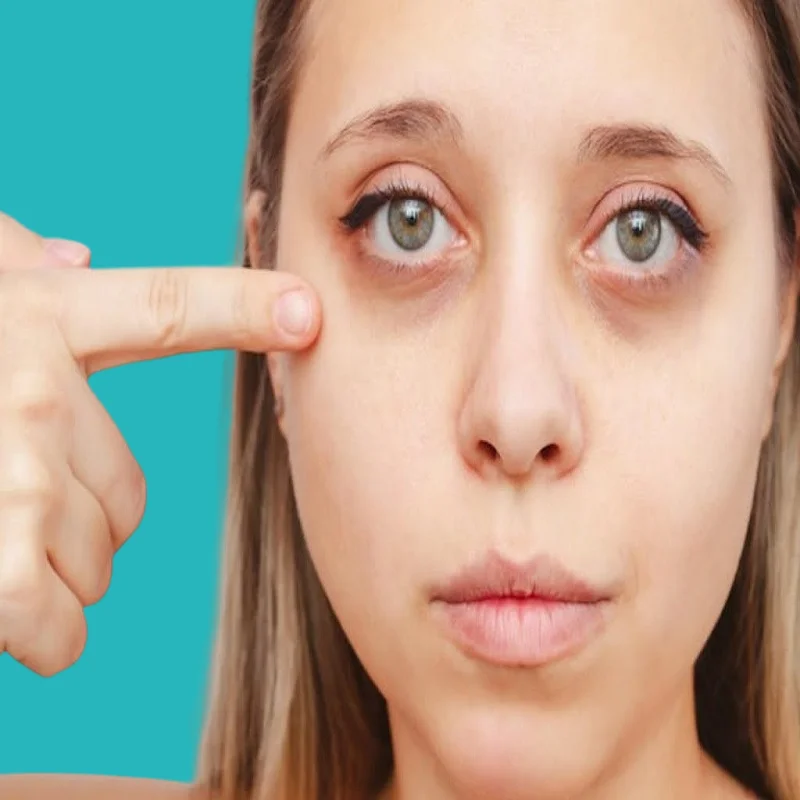 how to treat and prevent eye swelling? 