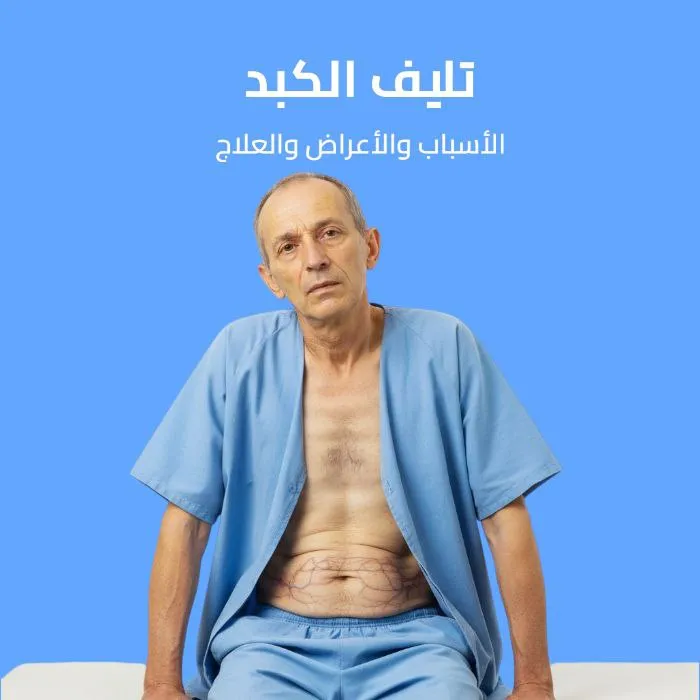 liver cirrhosis: causes, symptoms, and treatment 