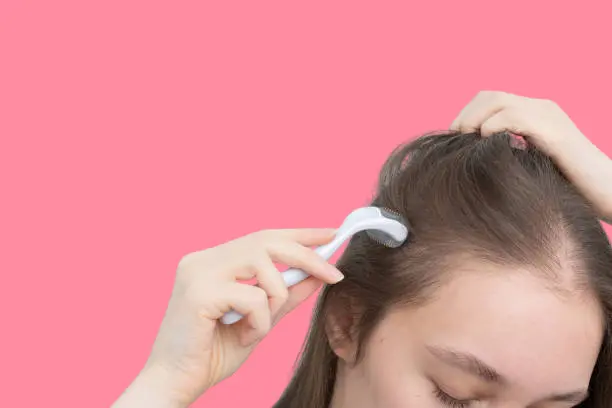 Derma roller for hair growth