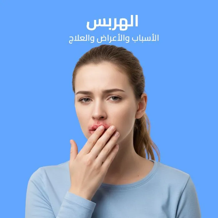 herpes: causes, symptoms, and treatment 