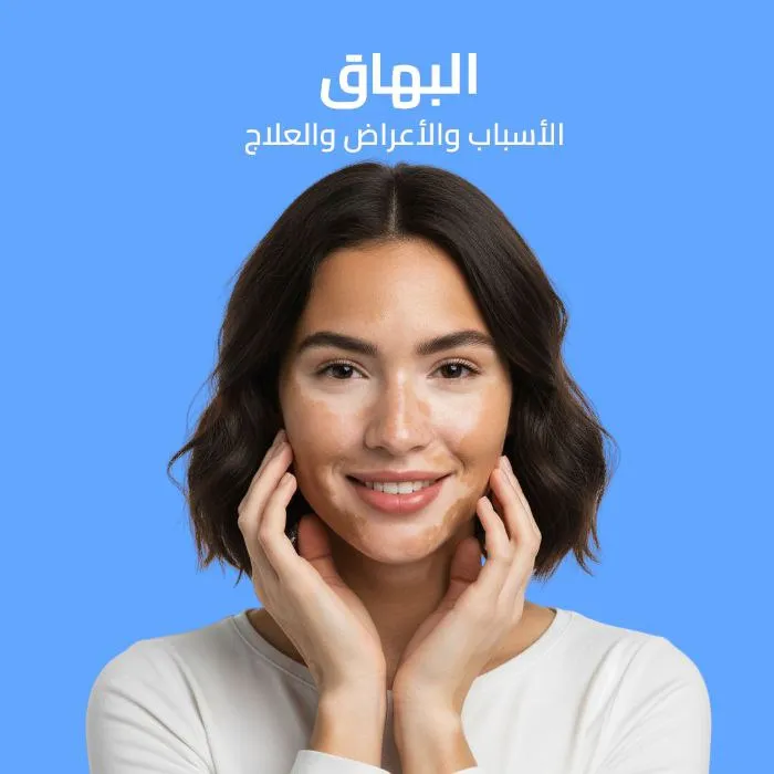 vitiligo: causes, symptoms, and treatment 