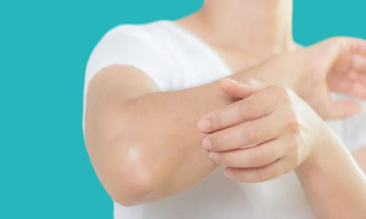 استخدام الكريمات المرطبة لعلاج النخالة البيضاء