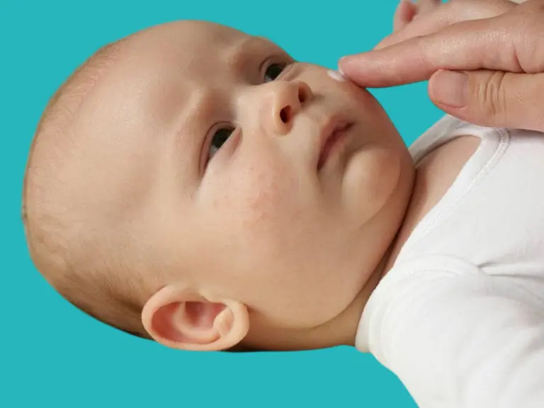 early childhood acne