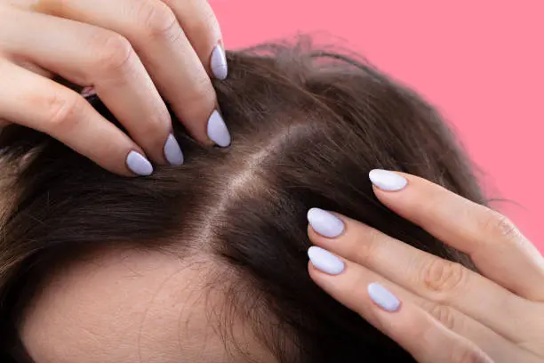Ways to care for an oily scalp