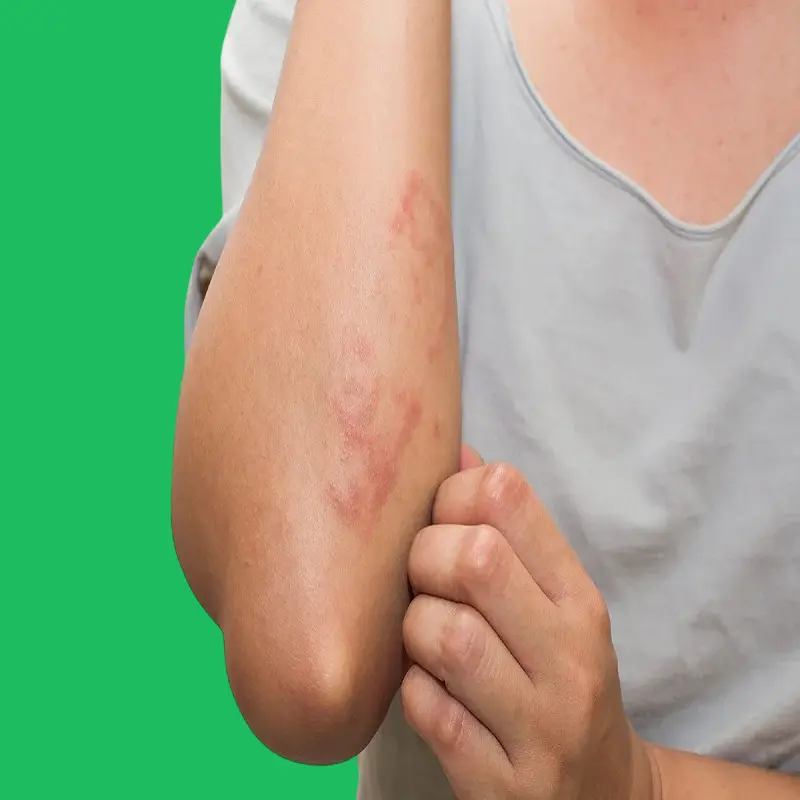 A healthy diet for people with wheat allergies 