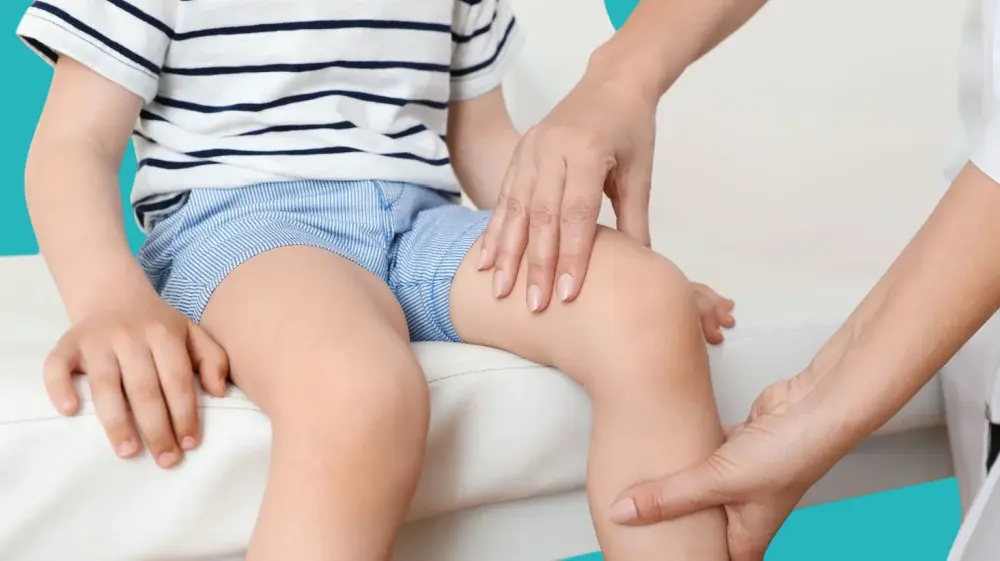 طرق لعلاج تقوس القدمين
