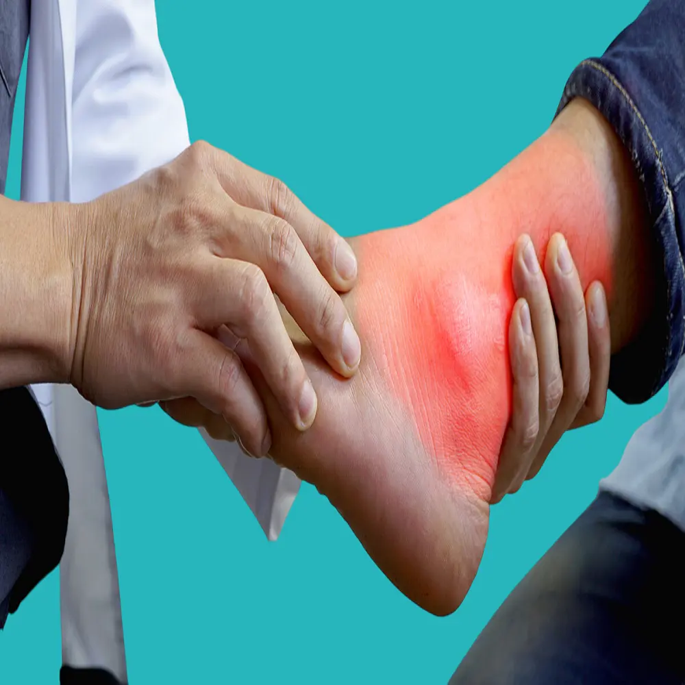 what is the difference between gout and salts? 