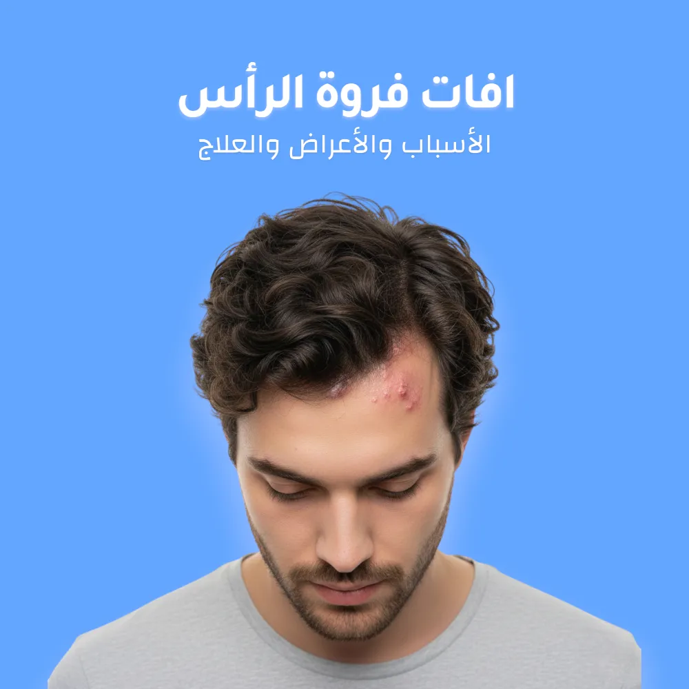 افات فروة الرأس: الأسباب والأعراض والعلاج 