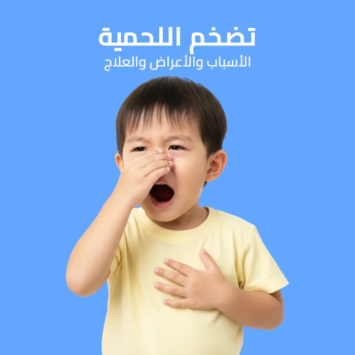 تضخم اللحمية: الأسباب والأعراض والعلاج 