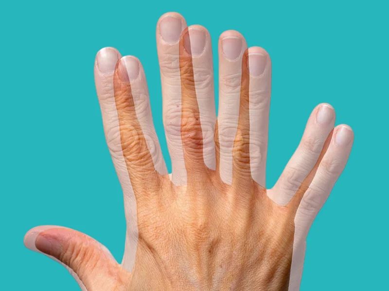 ازدواجية الرؤية من اعراض زغللة العين