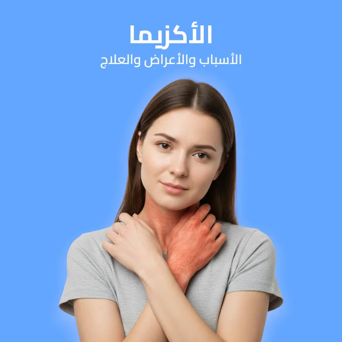 الأكزيما: الأسباب والأعراض والعلاج 
