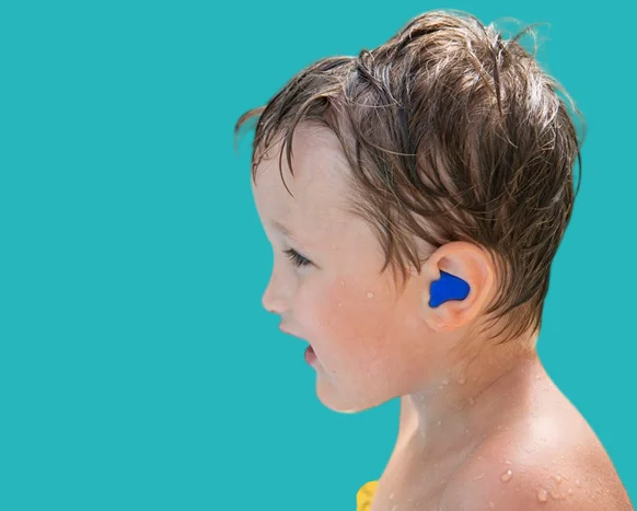 Using earplugs while swimming to prevent ear pain in children