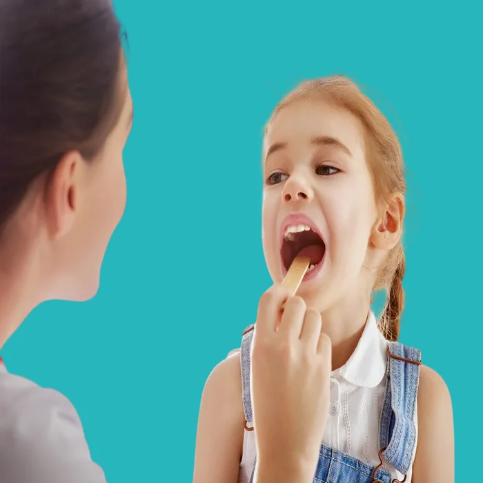 The best medicine for treating tonsillitis in children 