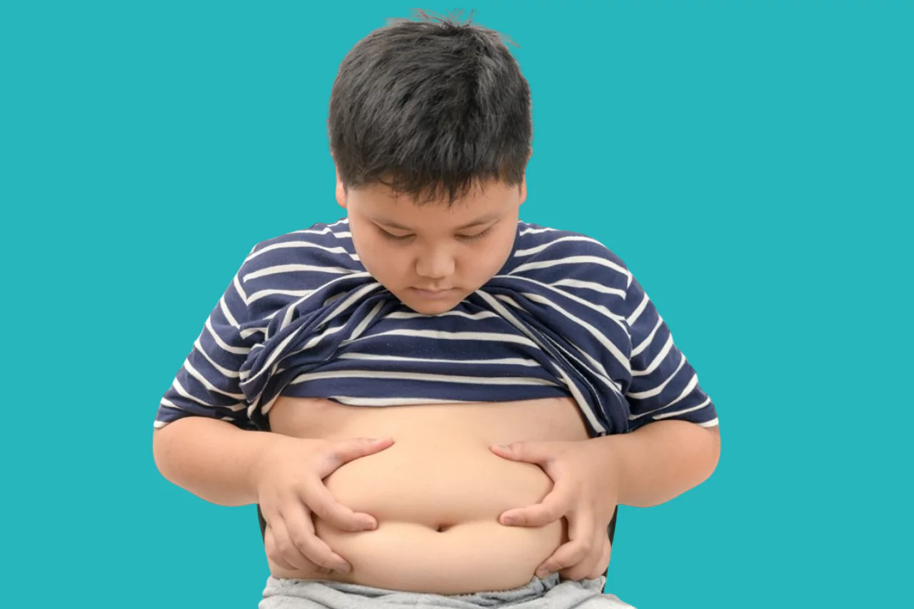 Obesity in Children