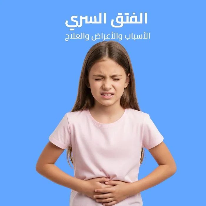 الفتق السري: الأسباب والأعراض والعلاج 