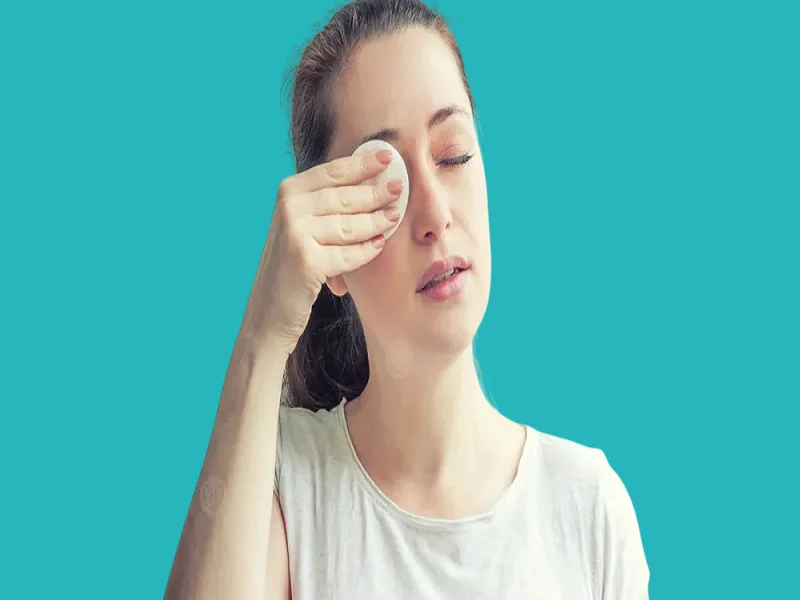 تدميع العين من اعراض الاصابة بالكيس الدهني في العين