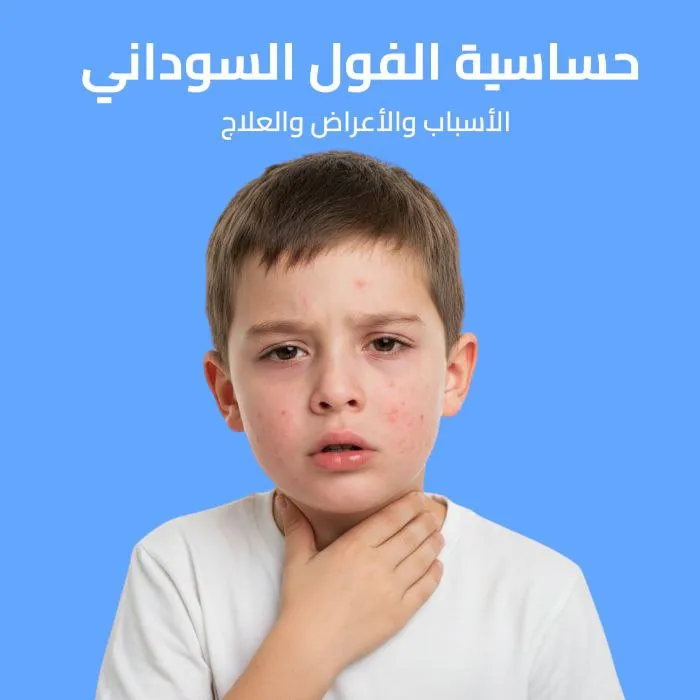 حساسية الفول السوداني: الأسباب والأعراض والعلاج 