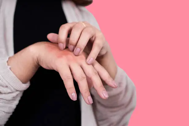 The effect of dish soap on hands