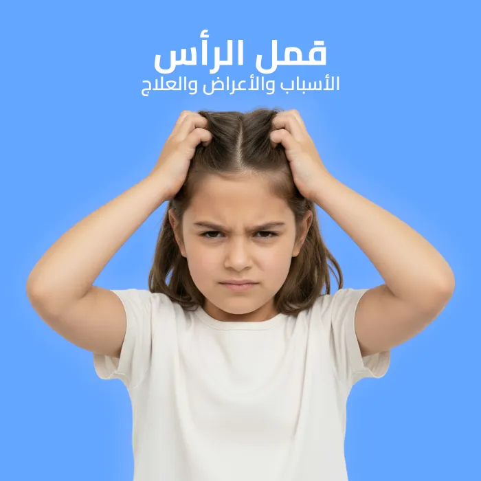 head lice: causes, symptoms, and treatment 