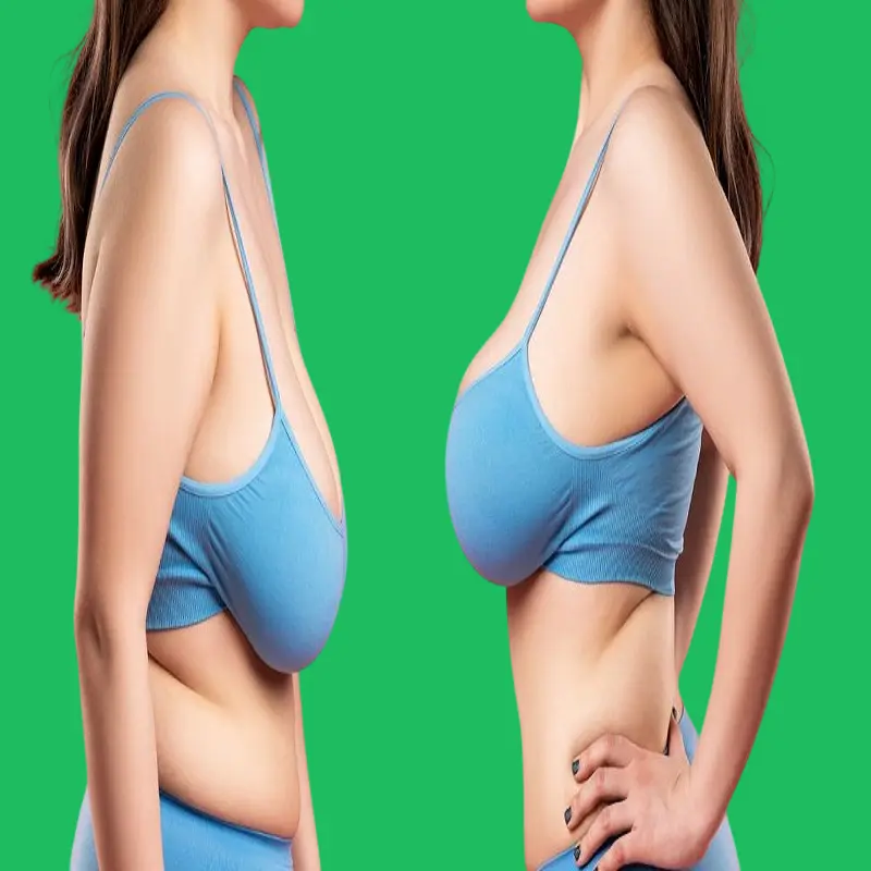 The best diet to reduce chest fat quickly 