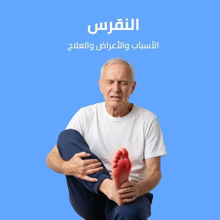 gout: causes, symptoms, and treatment 