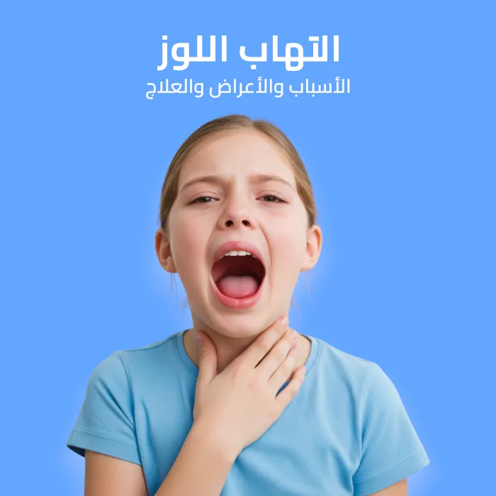 التهاب اللوز: الأسباب والأعراض والعلاج 