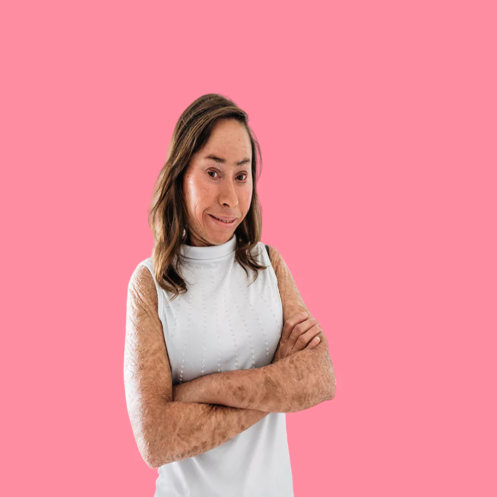 ما هو مرض السماك عند النساء واسبابه وطرق علاجه؟ 