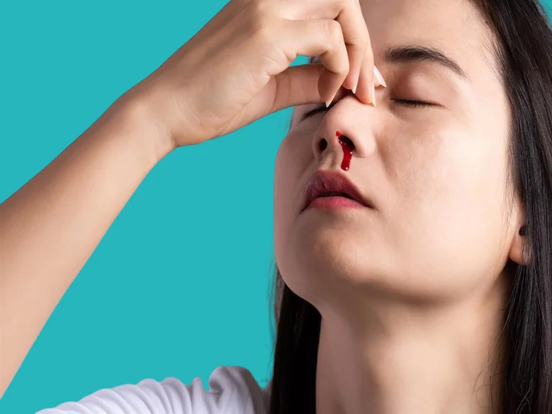 الاحساس بالدوخة من اعراض نزيف الانف