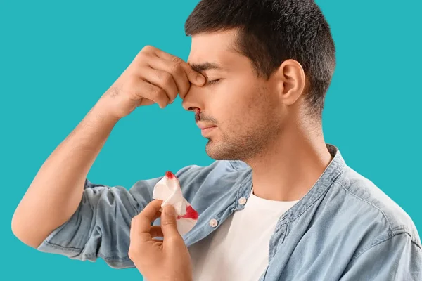 الجلوس في وضع مستقيم و الانحناء قليلا للامام من خطوات الاسعافات الاولية لنزيف الانف 