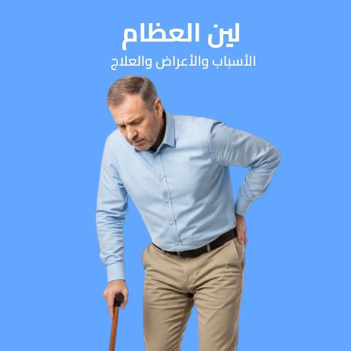 لين العظام: الأسباب والأعراض والعلاج 