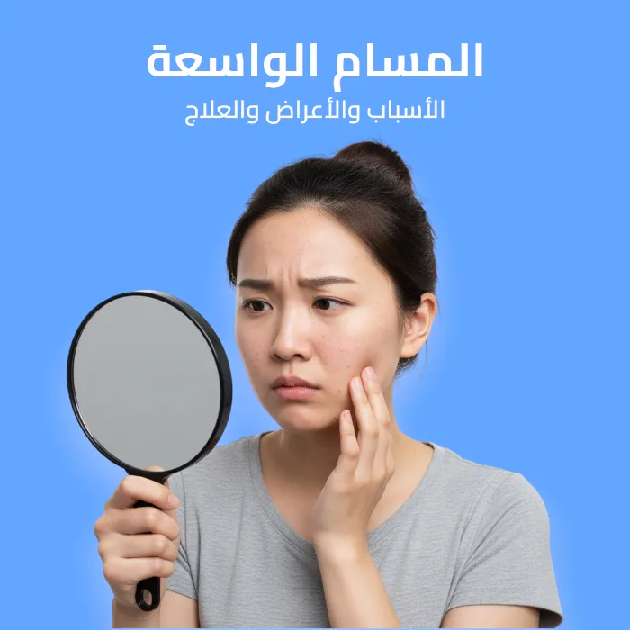 المسام الواسعة: الأسباب والأعراض والعلاج 