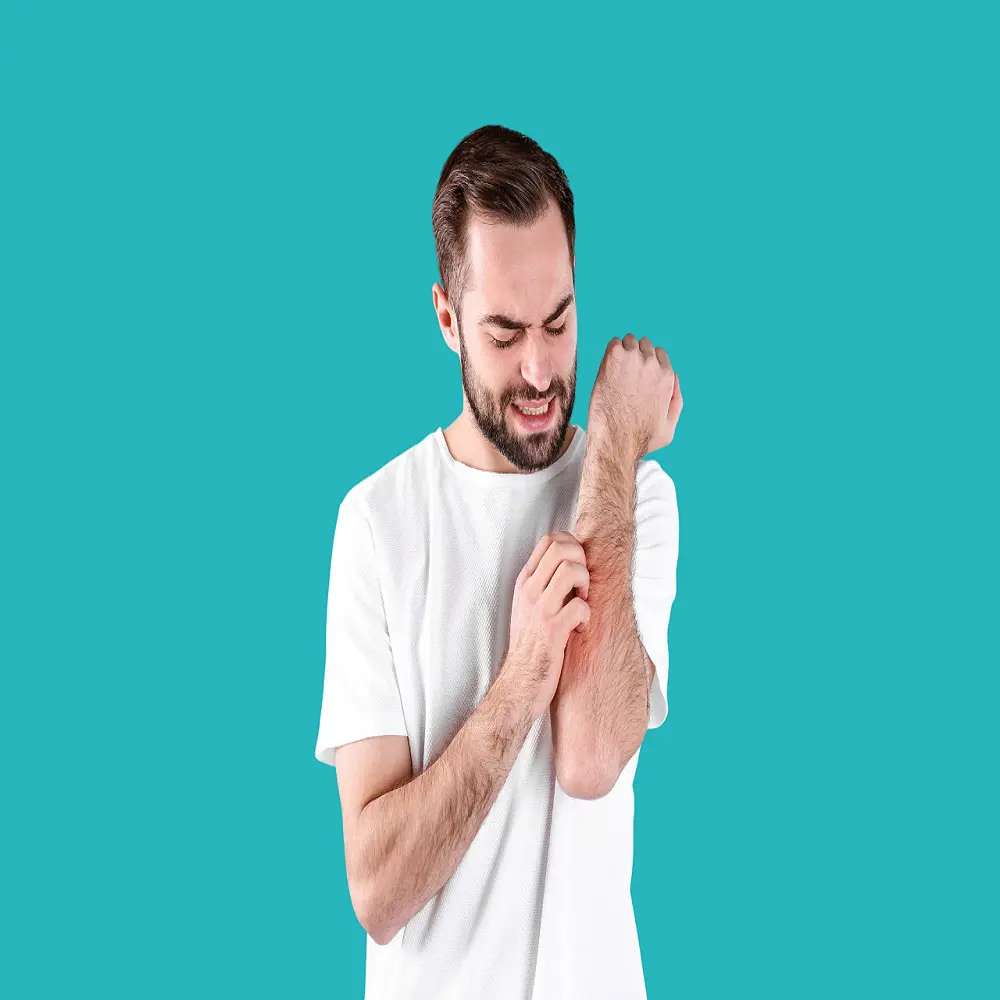 ما هو الفرق بين الجرب والحساسية واعراضهم؟ 