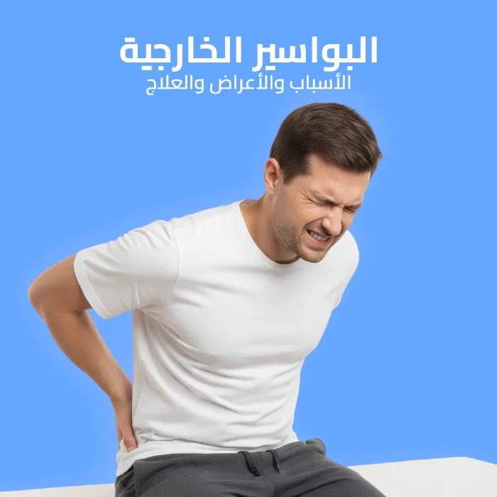 البواسير الخارجية: الأسباب والأعراض والعلاج 