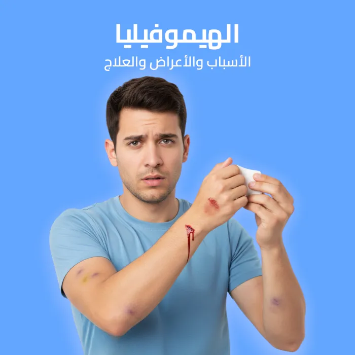 hemophilia: causes symptoms and treatment 