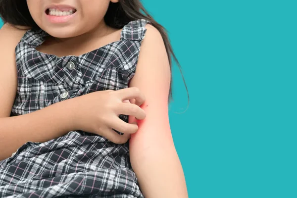 Itchy skin is one of the symptoms of eczema in children