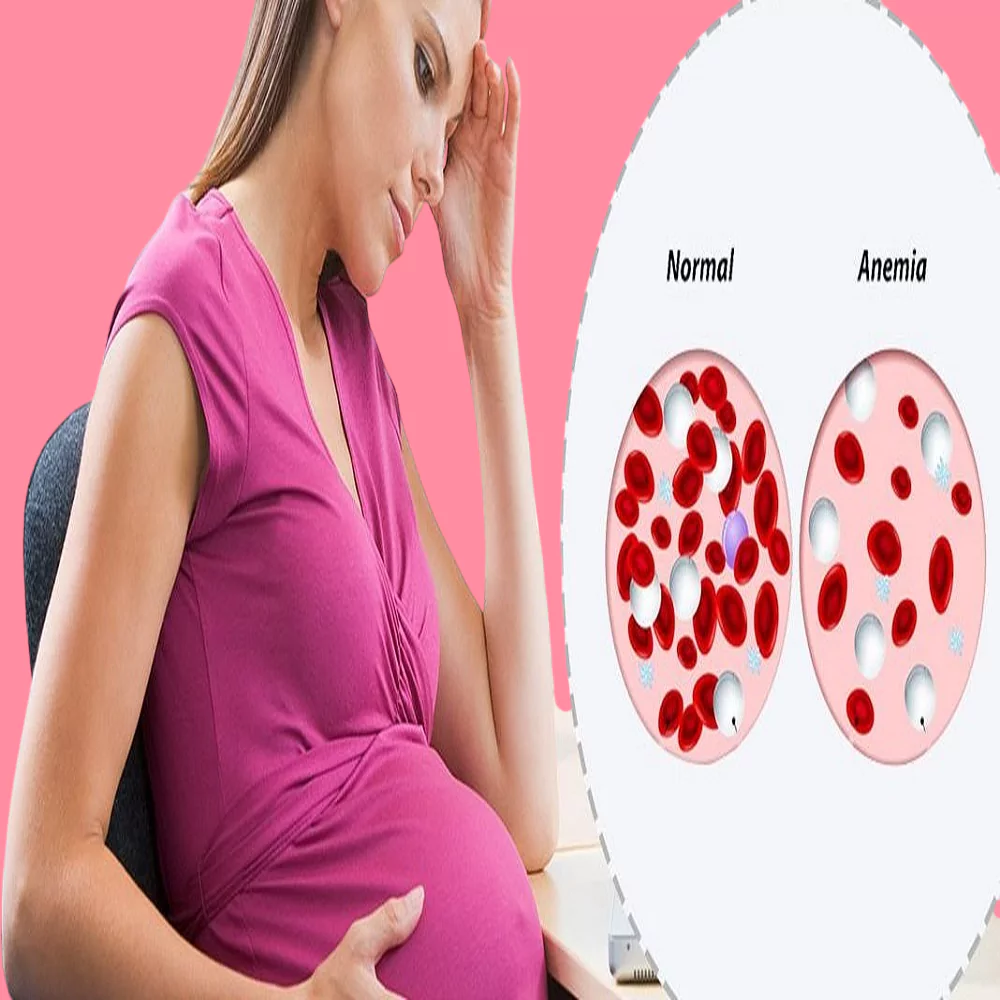 How to overcome anemia during pregnancy 